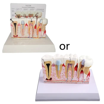 7x5.9x5.1inches שורש מודל לחינוך מחקר ללמד שיניים המודל